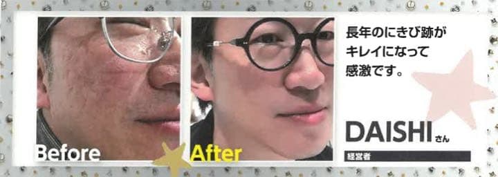 日本人のヒト幹細胞配合！ジェイセル J.CELLファーストジェル 30g