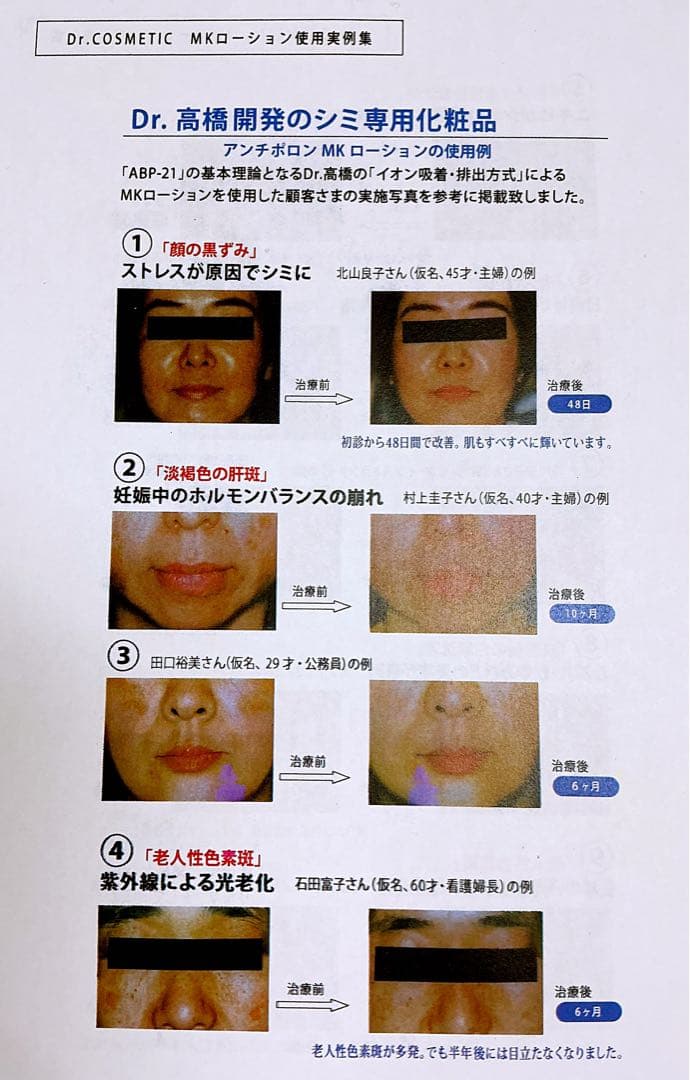 ヴィータ メラスマミルク (100ml) メラニン吸着　排出化粧料　シミ専用乳液