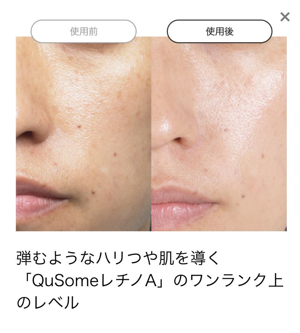 ビーグレンVC5・VA5・HQ5＋リセットマスク付。最高濃度レベル5の美容液