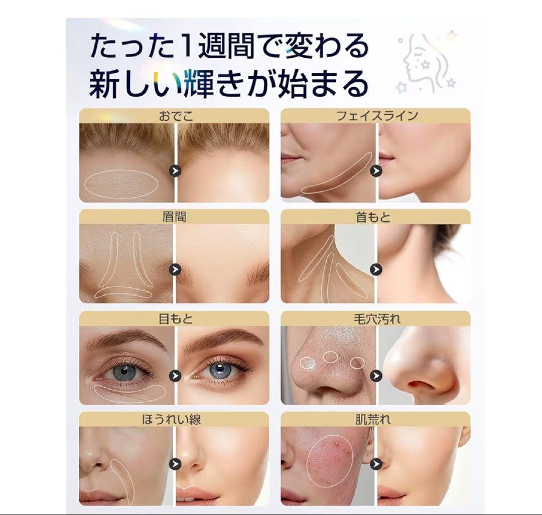 RF Beauty Device GlowLift Pro 美顔器1台18通り