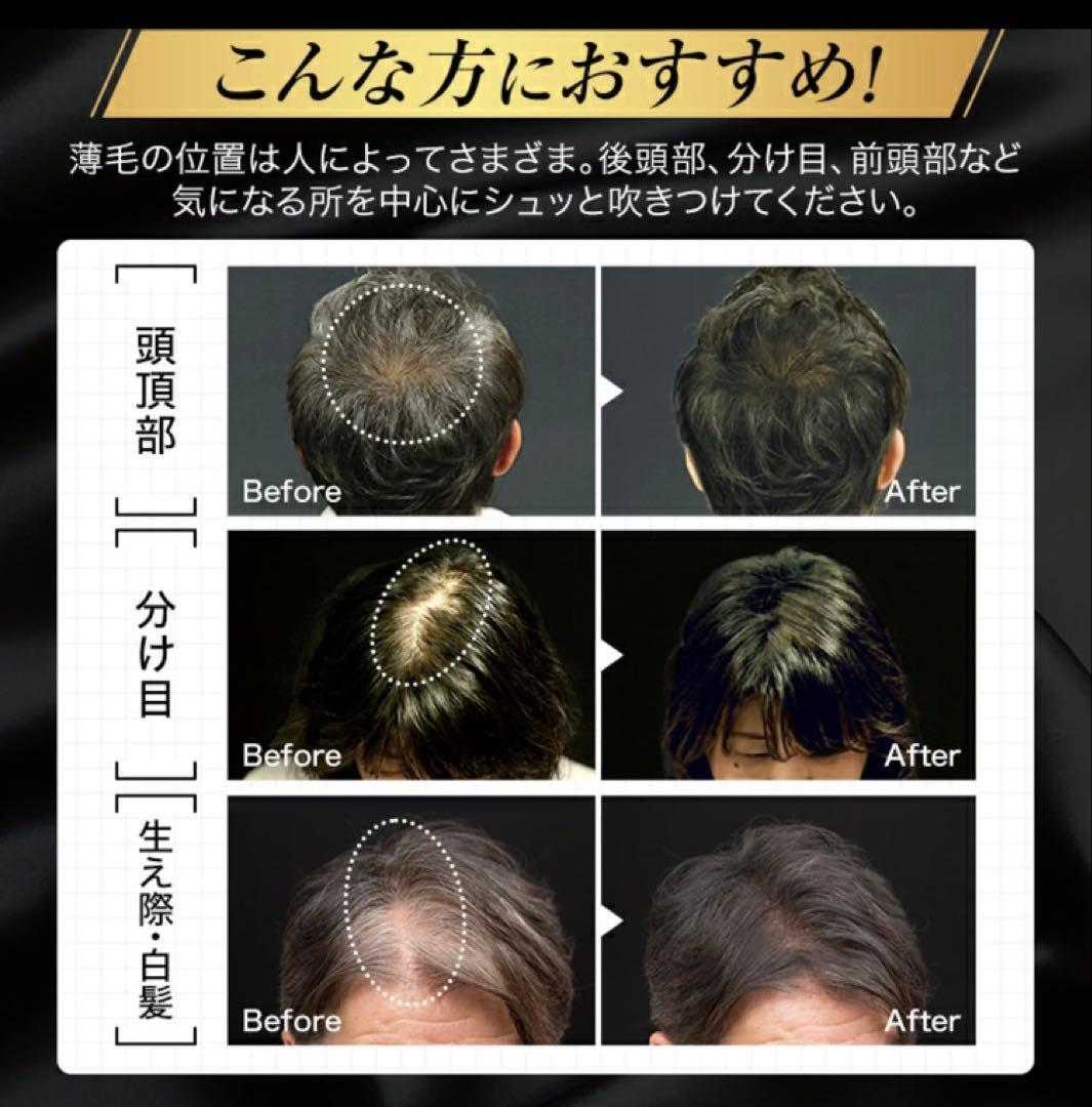 薄毛ハゲ隠しヘアスプレーaladin 200g 3本セット