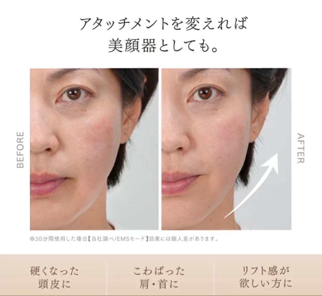 【未使用アタッチ】MYTREX HEAD SPA DEEP X ヘッドマッサージ