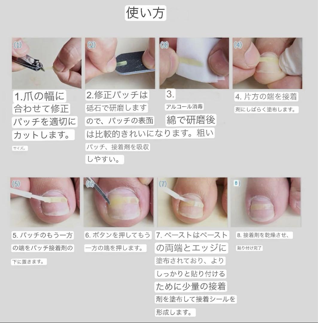 巻き爪　巻き爪矯正　プレート　50枚