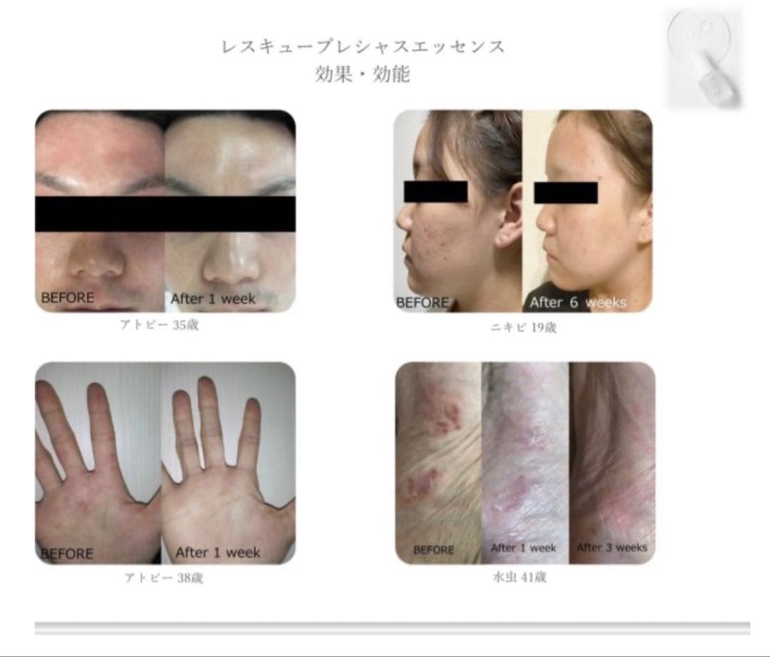 レスキュープレシャス　エッセンス アトピー ミトコンドリア ミネラル