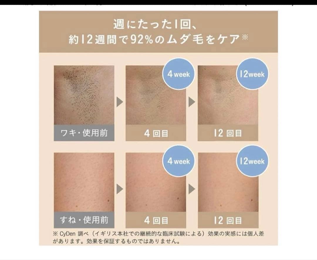 512410 スムーズスキン bare pop 脱毛器 (ライラック)