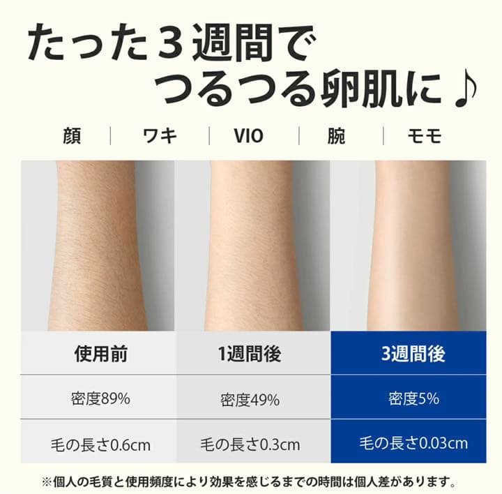 BoSidin  ダブルパルス技術 脱毛器 回数無制限