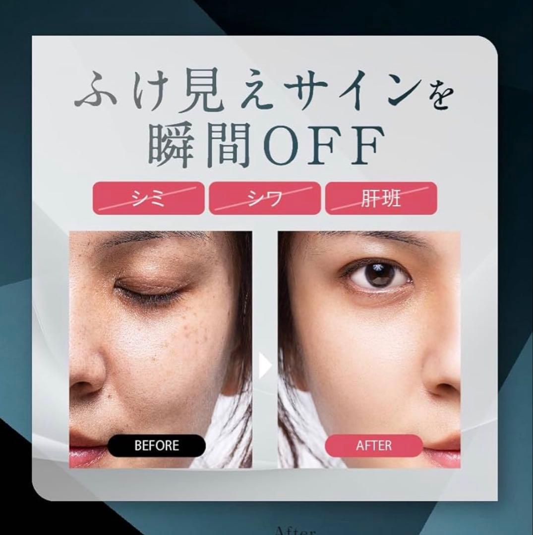 NNEファンデーション ニードルファンデ SPF50 PA++++ ニュートラル