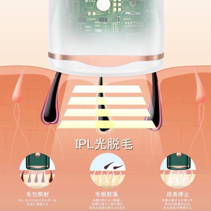 光脱毛器 IPL脱毛 美容機器 脱毛 除毛 ムダ毛ケア 自宅サロン VIO脱毛