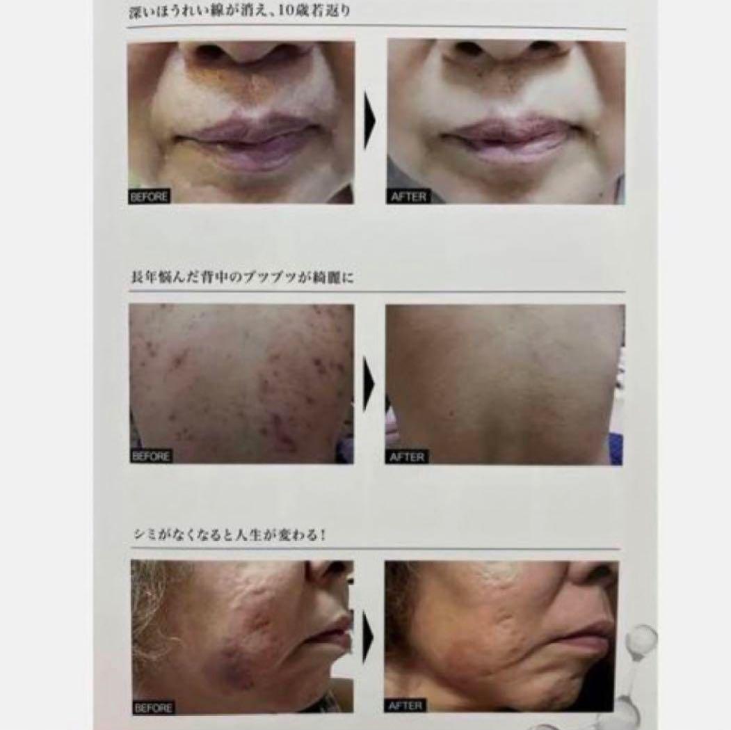 TR50 美容液 エステサロン 肌再生 高級 500ml モナリ