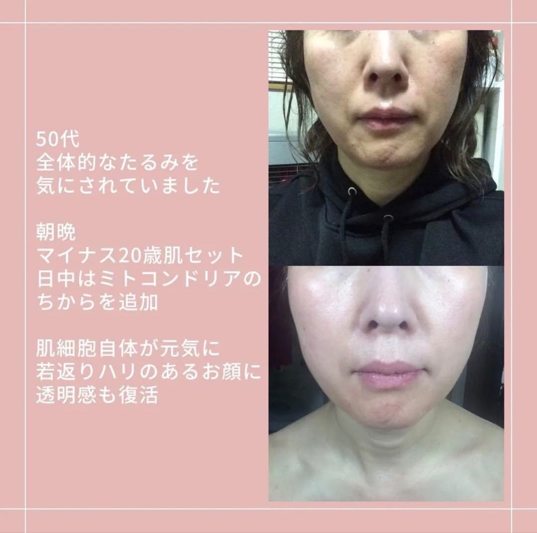 アキノリオ　New マイナス20歳肌セット　ジャー容器ミト