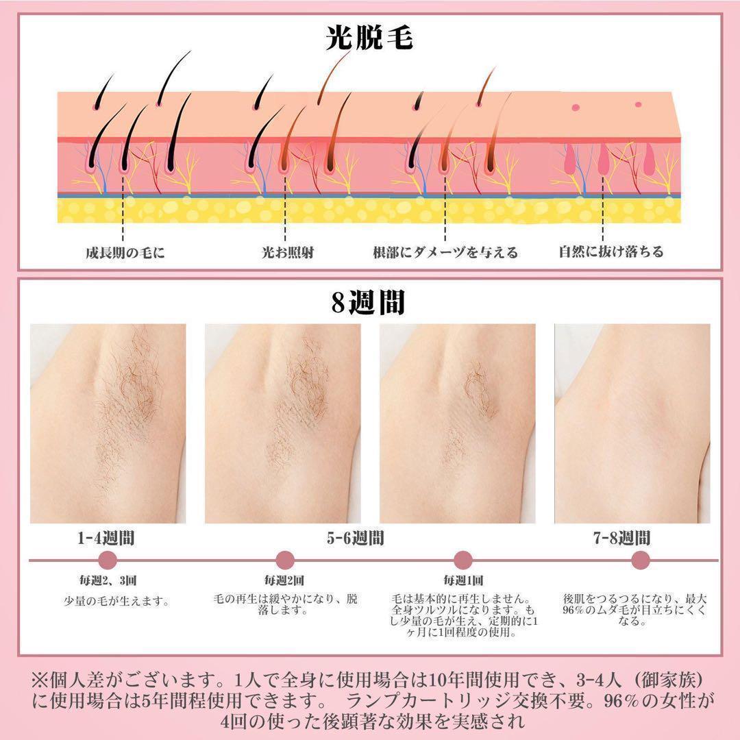 ⭐️夏までにツルツルに⭐️ IPL光脱毛器 99万回照射 5段階調節 家庭用脱毛