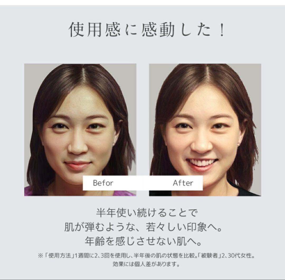beluluフォトフェイシャル 美顔器 リフトアップ 光美容器【美ルル ヒカリ】