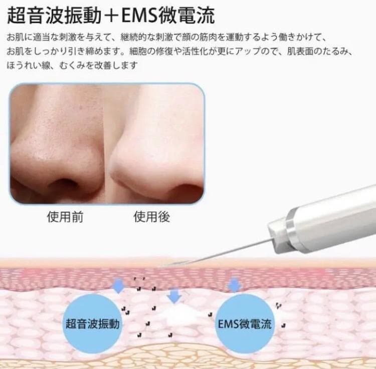 エステサロン同等2.4w回/秒の超音波振動❣自宅で毎日スペシャルケア♪❤美顔器