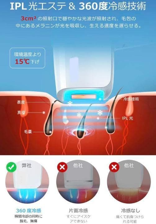 【現品限り☆大特価】最新WPL機能搭載 IPL脱毛器 99万回照射 5段階調整