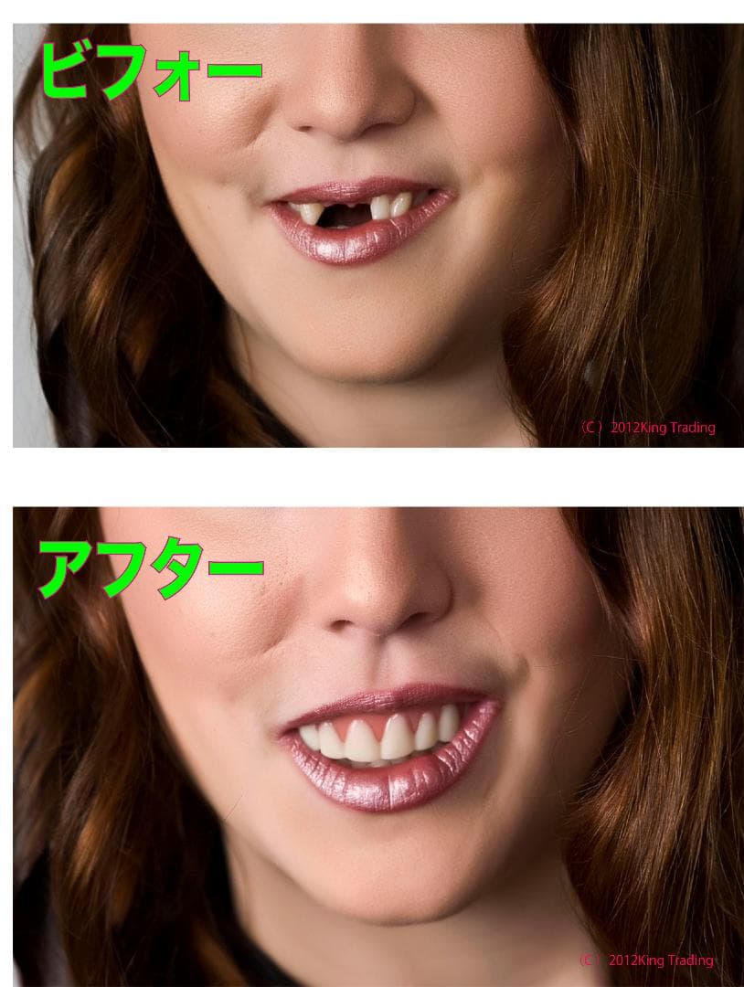 まりままさん専用＜ミディアムx5＞